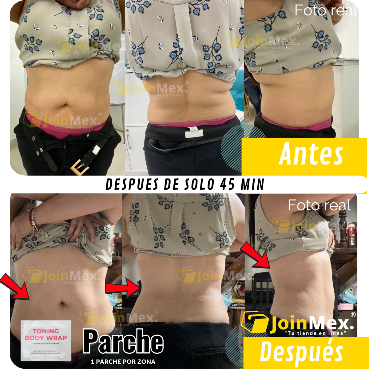 Parche reductor de tallas en solo 45 minutos