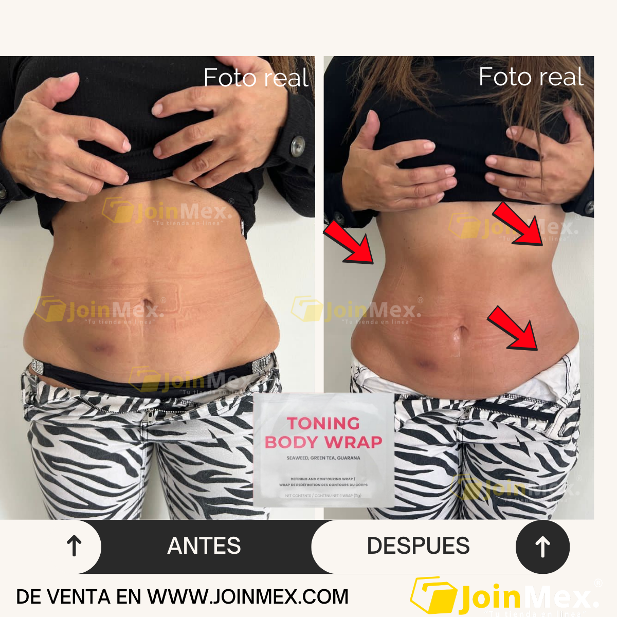 Parche reductor de tallas en solo 45 minutos