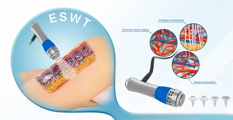 Máquina de terapia de ondas de choque enfocadas electromagnéticas con tratamie