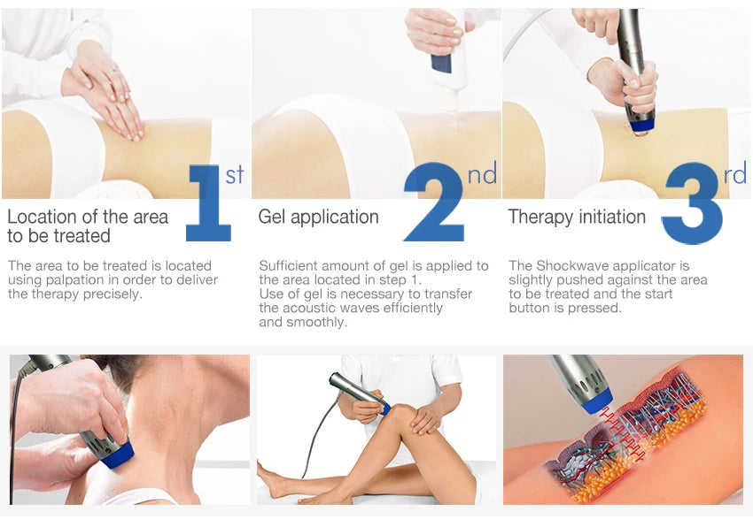 Máquina de terapia de ondas de choque enfocadas electromagnéticas con tratamie