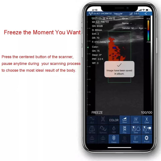 Doppler-escáner USB de fisioterapia de rehabilitación Vascular, ultrasonido de mano inalámbrico, doble lineal para diagnóstico de cuerpo completo