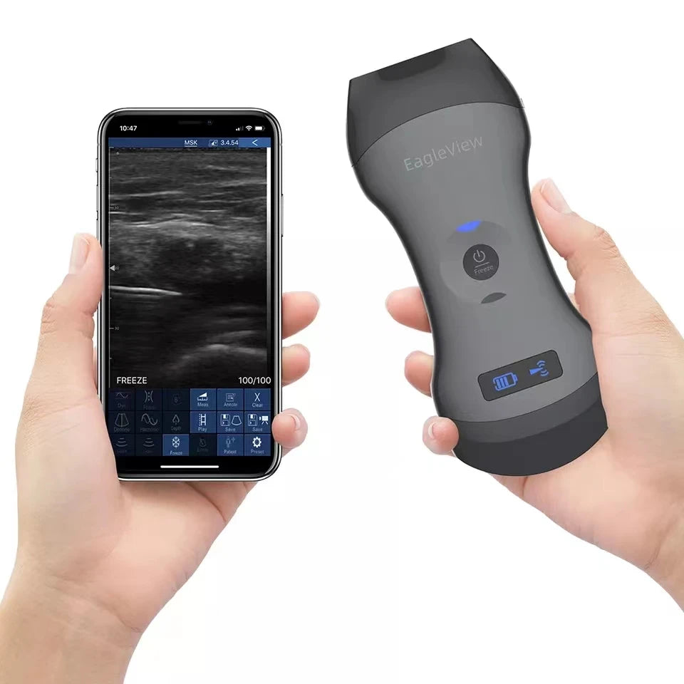 Doppler-escáner USB de fisioterapia de rehabilitación Vascular, ultrasonido de mano inalámbrico, doble lineal para diagnóstico de cuerpo completo
