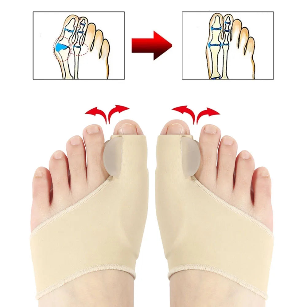 Bunion Corrector Orthotics 2 Pcs = 1 Pair Toe Separators