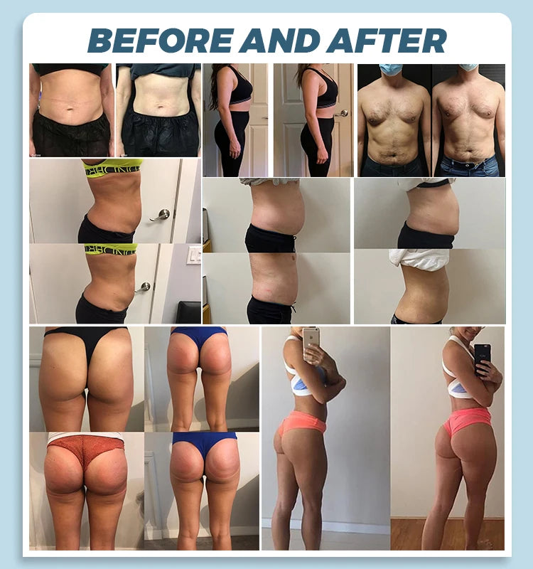 Emsslim-estimulador muscular profesional Neo, máquina de modelado de tren muscu