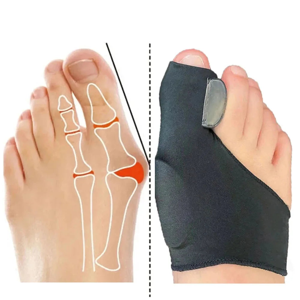 Bunion Corrector Orthotics 2 Pcs = 1 Pair Toe Separators